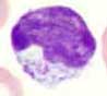 Lymphocyte