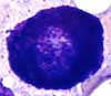 Mast cell