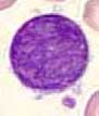 Megakaryocyte remnant