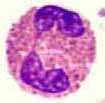 Eosinophiler